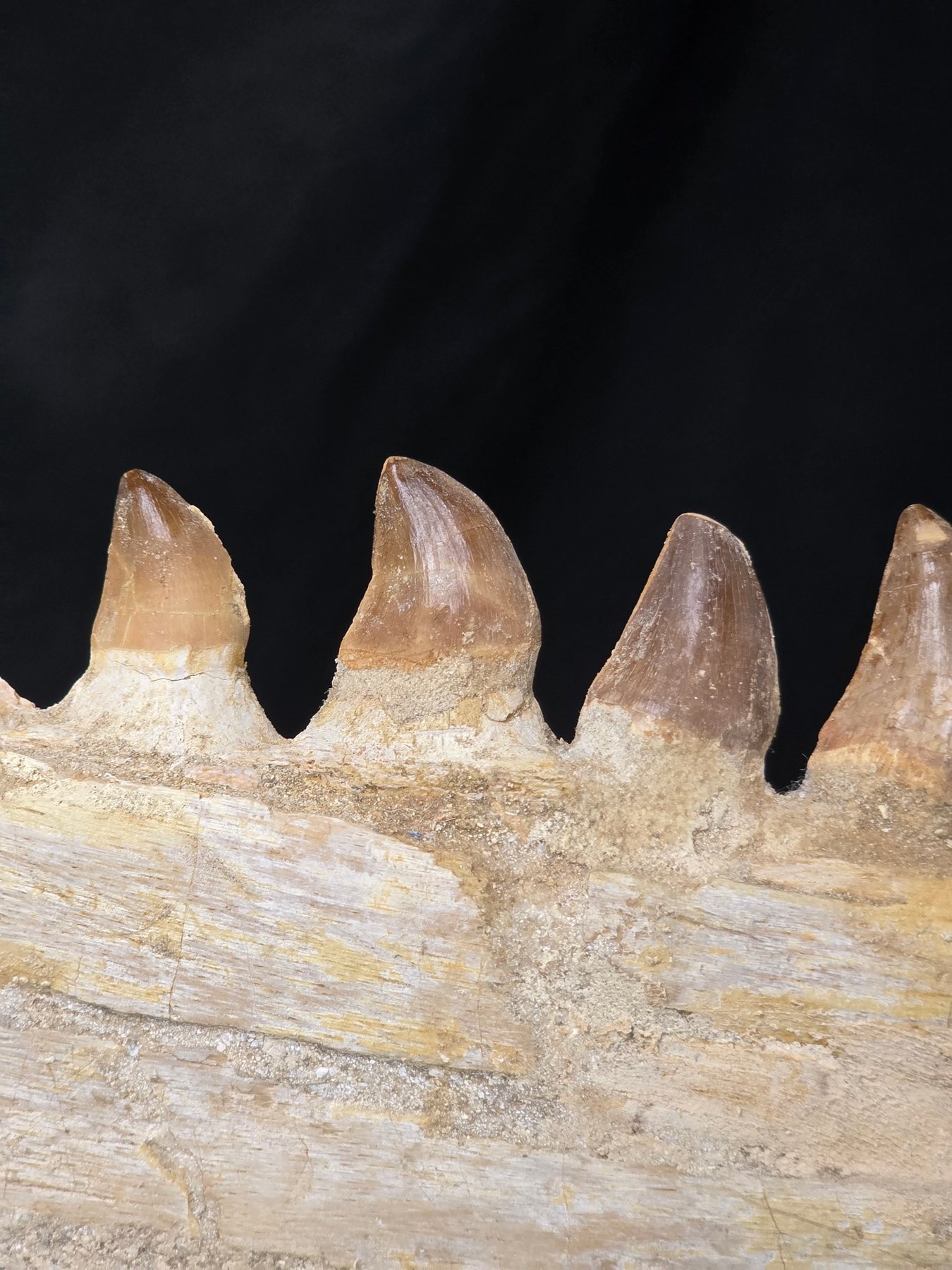 Detail — tooth crowns close-up A