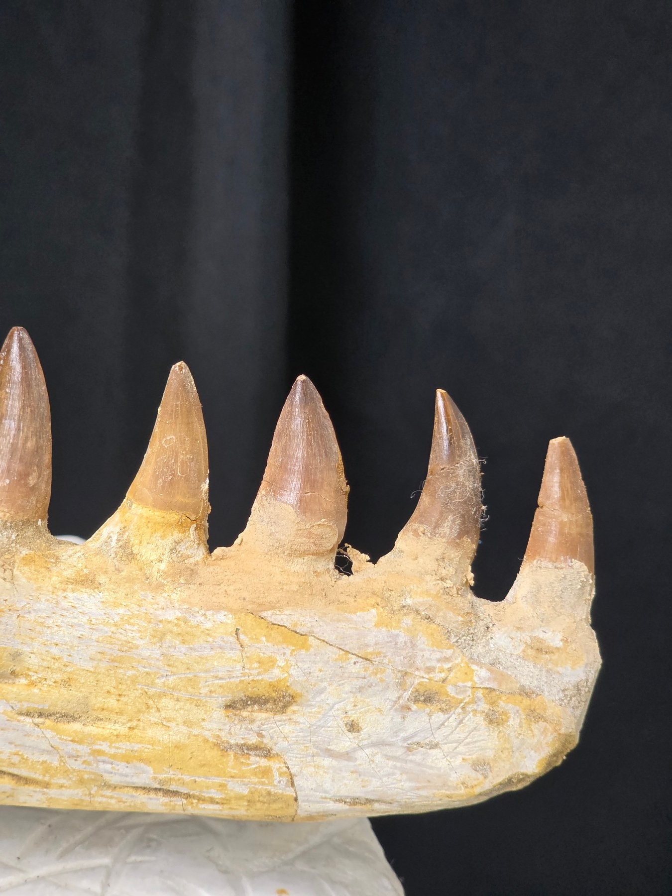 Detail — tooth crowns close-up B