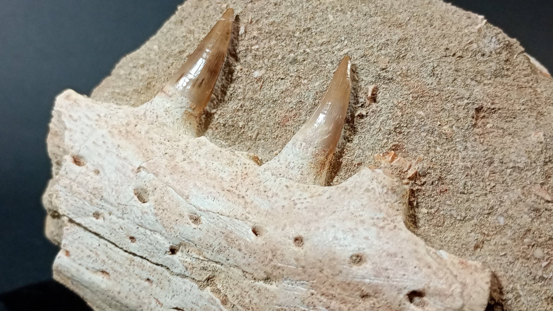 Teeth angled