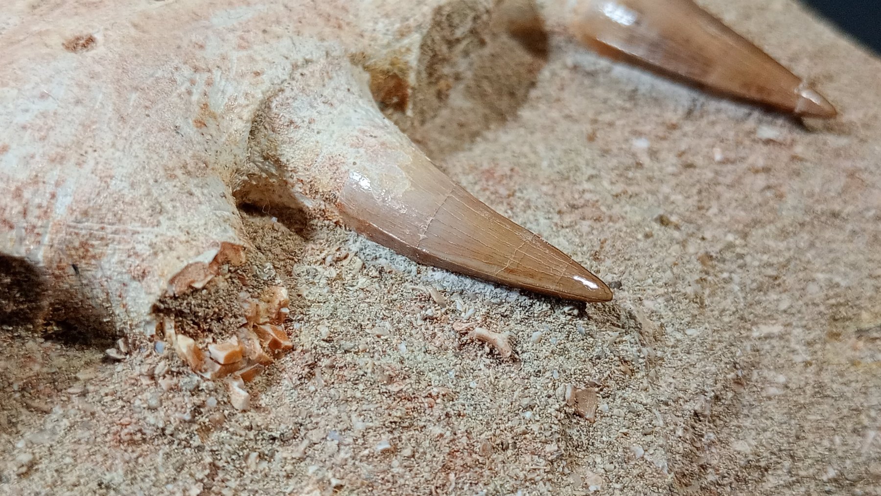 Single tooth detail