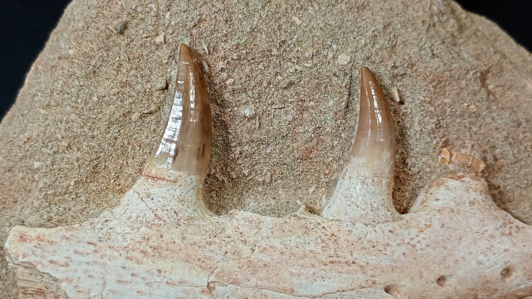 Teeth close-up frontal