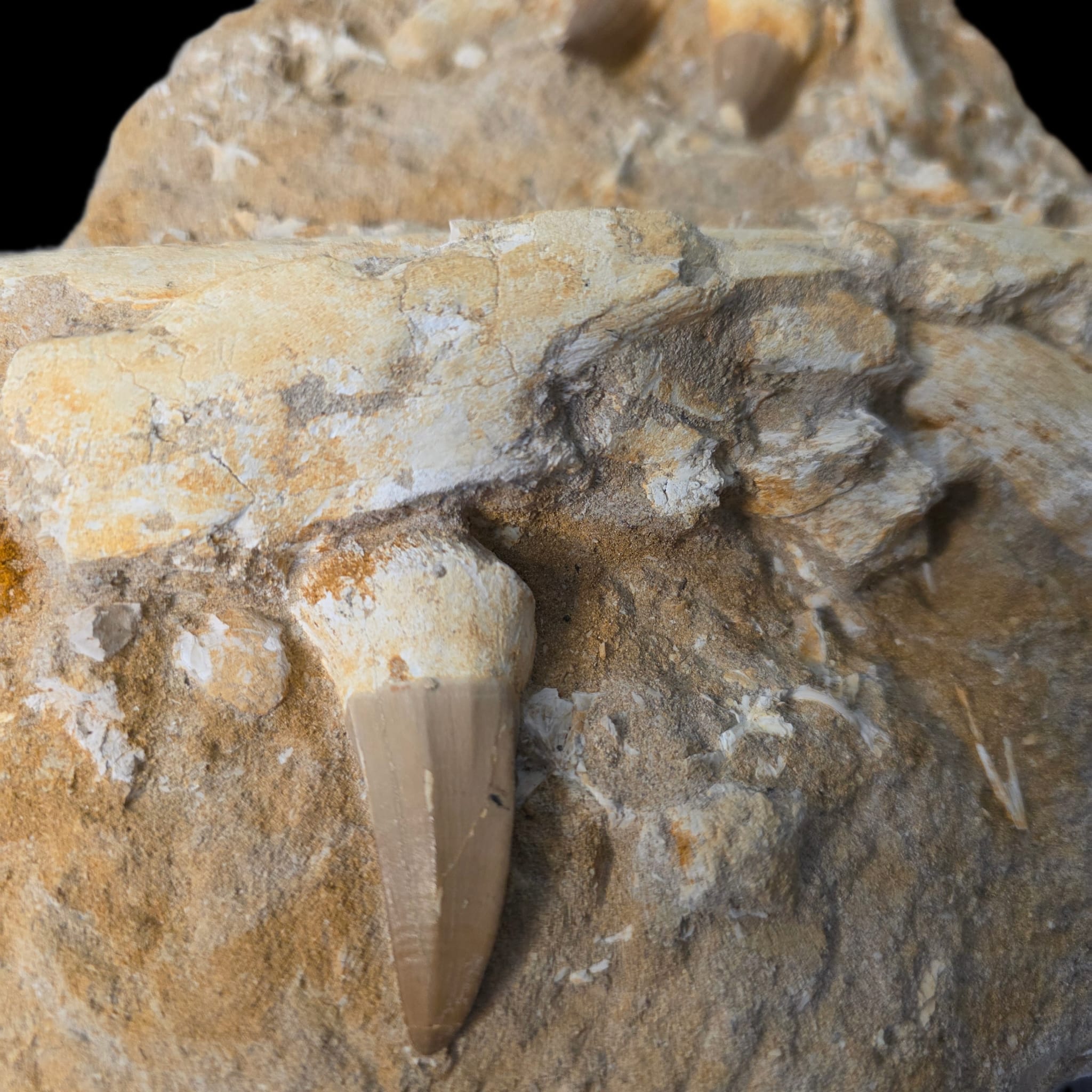 Single tooth close-up